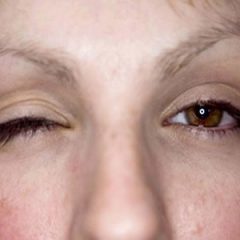Imagem da notícia: Tremor nas pálpebras associado a stress