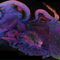 Imagem da notícia: Cientistas criam cérebros através de células estaminais