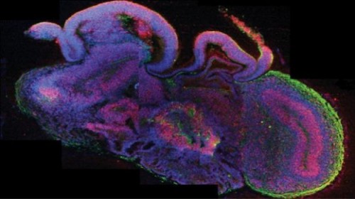 Imagem da notícia: Cientistas criam cérebros através de células estaminais