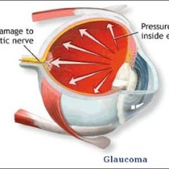 Imagem da notícia: Descoberto novo método de detetar glaucoma