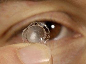 Imagem da notícia: Primeira córnea artificial implantada em Granada