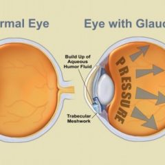 Imagem da notícia: Semana Mundial do Glaucoma é em setembro