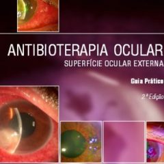 Imagem da notícia: Guia Pr&aacute;tico sobre Antibioterapia na Superf&iacute;cie Ocular