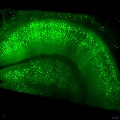Imagem da notícia: Novo microsc&oacute;pio avan&ccedil;ado com tecnologia para cria&ccedil;&atilde;o de imagens de tecidos
