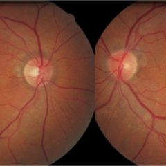 Imagem da notícia: Nova revista dedicada &agrave; retina