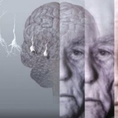 Imagem da notícia: Alzheimer associado à produção desregulada de moléculas mensageiras