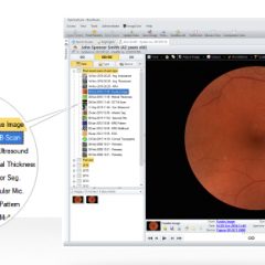 Imagem da notícia: Conhece o OphtalSuite?