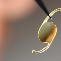 Imagem da notícia: Lentes trifocais protagonistas na CIRP