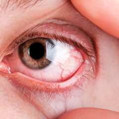 Imagem da notícia: Estudo: Sintomas Oculares durante o Confinamento