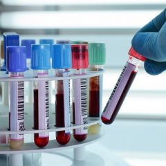 Imagem da notícia: Covid-19: Parceria junta empresas de plasma