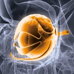 Imagem da notícia: CUF Descobertas realiza reunião sobre tumores orbitários