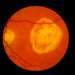 Imagem da notícia: Reconstrução do tecido ocular poderá fornecer novos insights sobre retina externa