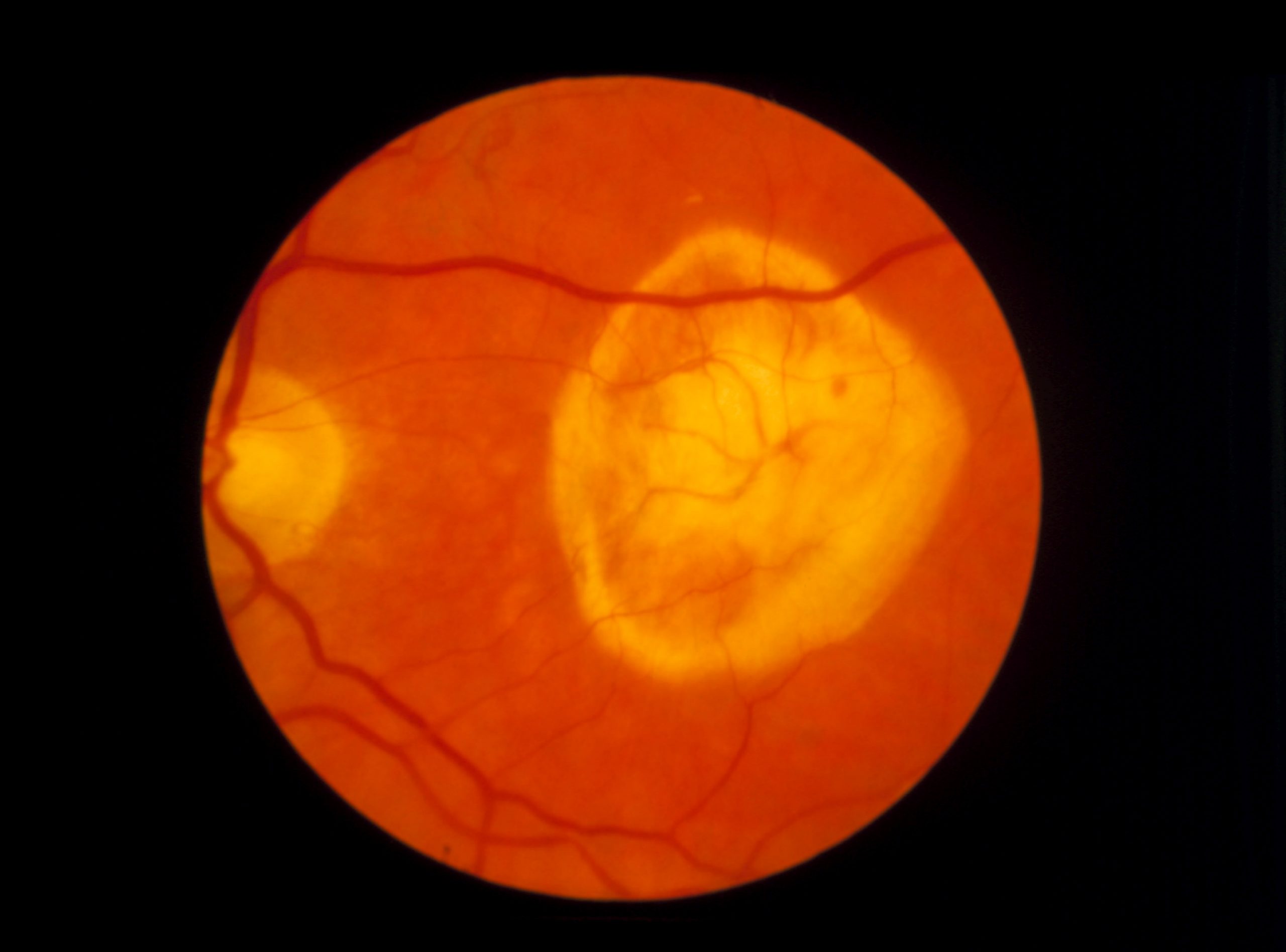 Imagem da notícia: Reconstrução do tecido ocular poderá fornecer novos insights sobre retina externa