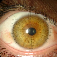 Imagem da notícia: Curso “Contactologia Avançada e Superfície Ocular” com inscrições abertas