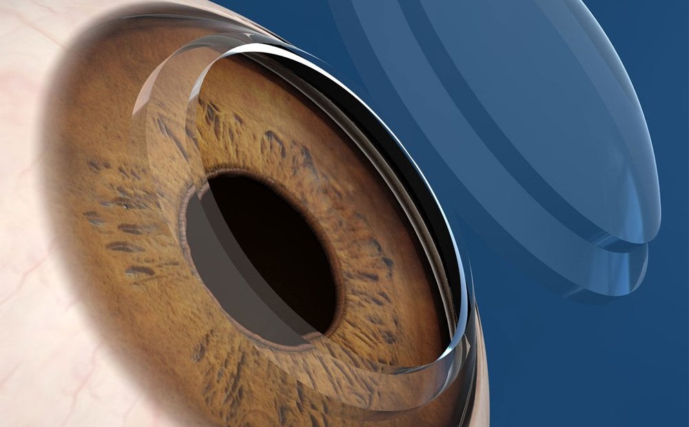 Imagem da notícia: Células estaminais podem melhorar visão de pessoas com doença ocular
