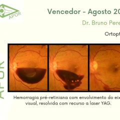 Imagem da notícia: APOR: Bruno Pereira é o vencedor do “desafio fotográfico” de agosto