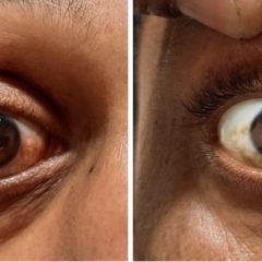 Imagem da notícia: Olhos vermelhos e bandeiras vermelhas