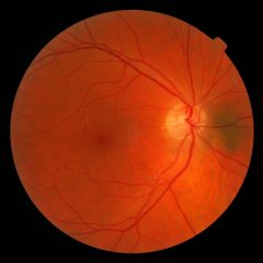 Imagem da notícia: “As Quartas da SPO” com novo debate