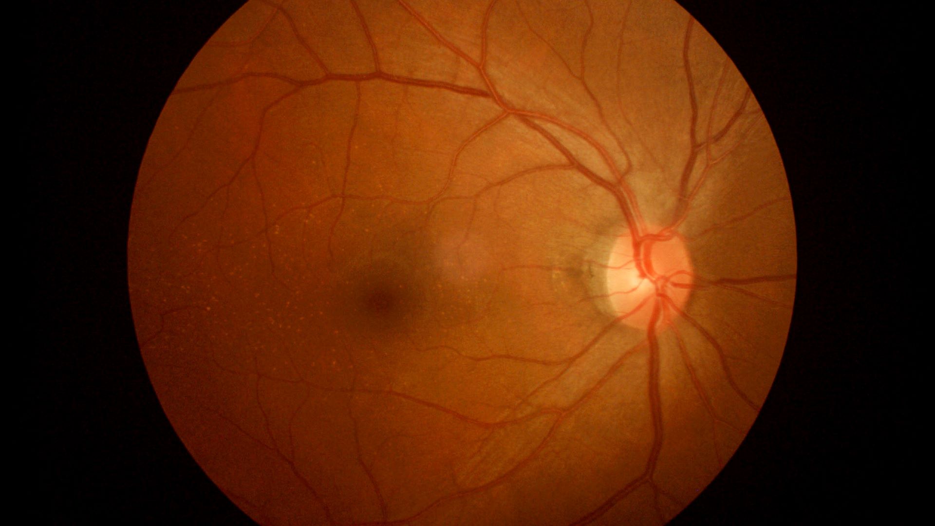 Imagem da notícia: Mapas de retina de alta resolução auxiliam no diagnóstico de doenças