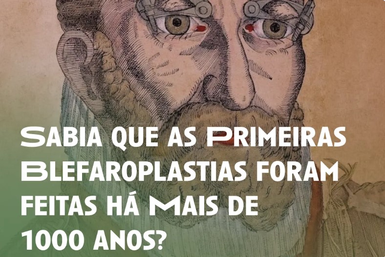 Imagem da notícia: SPO “De Olho na Cultura” revisita a história das primeiras blefaroplastias