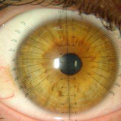 Imagem da notícia: UMinho lança 13ª edição do curso online Contactologia Avançada e Superfície Ocular