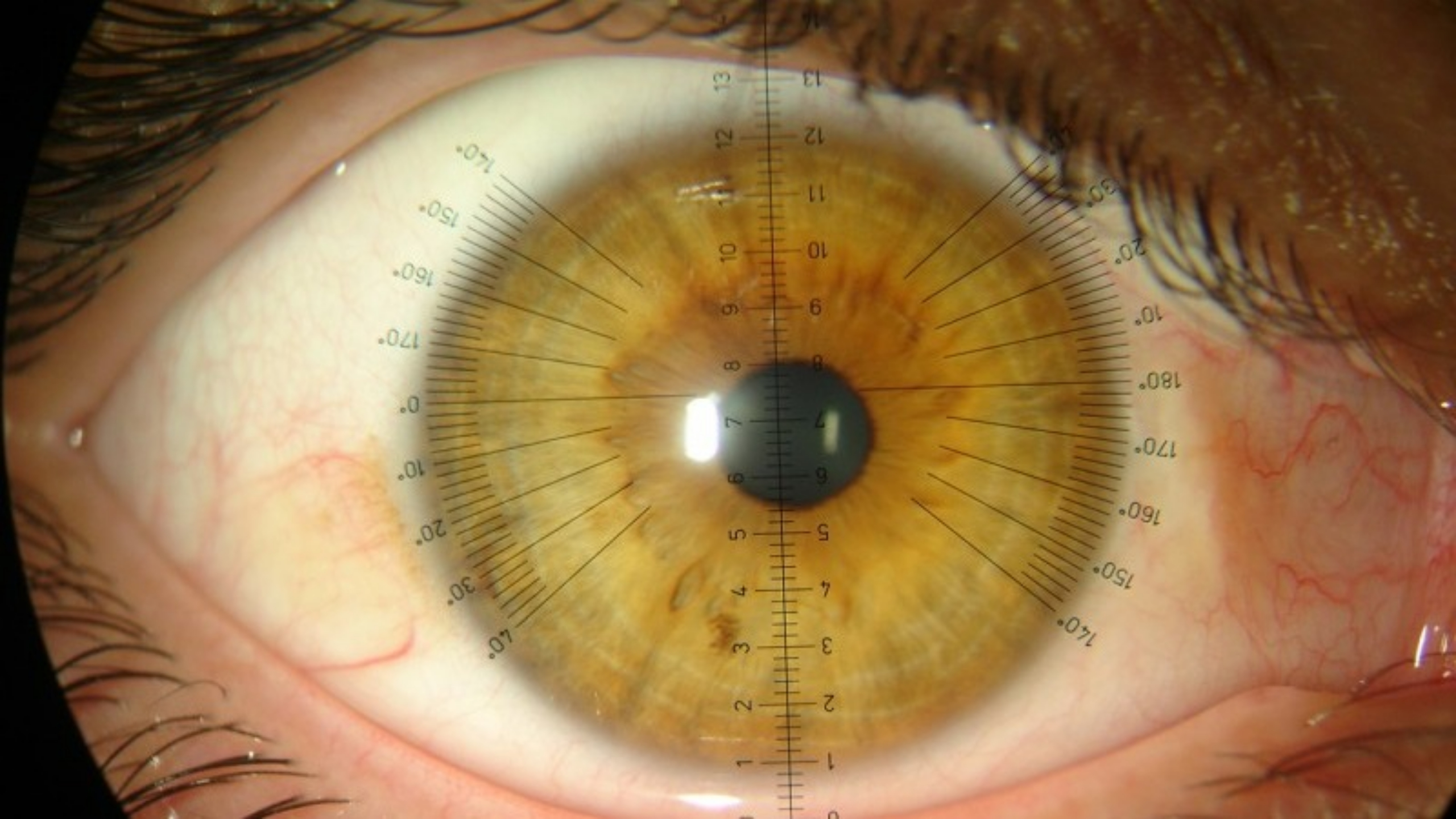 Imagem da notícia: UMinho lança 13ª edição do curso online Contactologia Avançada e Superfície Ocular