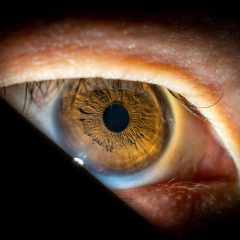 Imagem da notícia: Uveíte pesa na qualidade de vida visual, sugere estudo